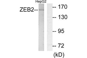 Western blot analysis of extracts from HepG2 cells, using ZEB2 antibody. (ZEB2 抗体  (N-Term))