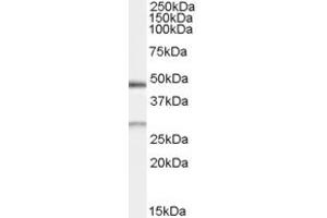 Western Blotting (WB) image for anti-BCL2/adenovirus E1B 19kDa Interacting Protein 1 (BNIP1) antibody (ABIN5858878) (BNIP1 抗体)