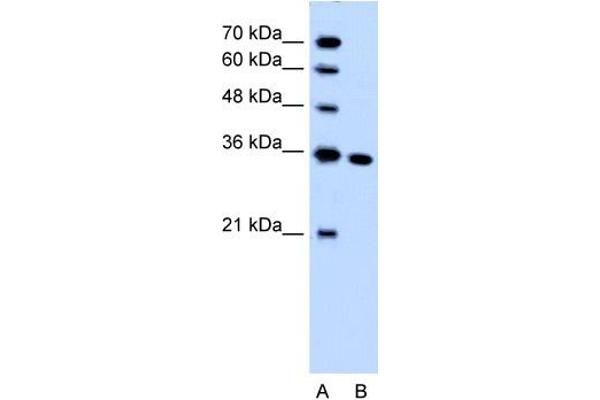 SLC25A29 抗体  (C-Term)