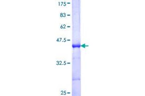 PDK4 Protein (AA 181-280) (GST tag)