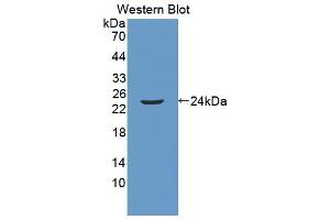 Western blot analysis of the recombinant protein. (Anoctamin 2 抗体  (AA 823-1003))