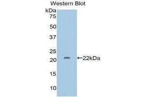 Detection of Recombinant IL1a, Human using Polyclonal Antibody to Interleukin 1 Alpha (IL1a) (IL1A 抗体  (AA 95-269))