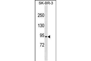 Western blot analysis in SK-BR-3 cell line lysates (35ug/lane). (RFWD2 抗体  (C-Term))