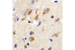 Immunohistochemistry (IHC) image for anti-ST8 alpha-N-Acetyl-Neuraminide alpha-2,8-Sialyltransferase 2 (ST8SIA2) antibody (ABIN7308376) (ST8SIA2 抗体)