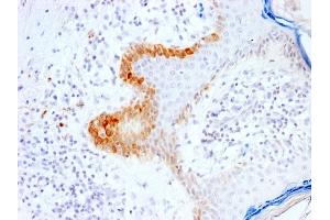 Immunohistochemistry (IHC) image for anti-Keratin 15 (KRT15) antibody (ABIN6939916)