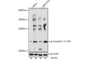 Western blot analysis of extracts of various cell lines, using Phospho-Caveolin-1-Y14 Rabbit pAb (ABIN6135195, ABIN6136032, ABIN6136033 and ABIN6225647) at 1:1000 dilution. (Caveolin-1 抗体  (pTyr14))