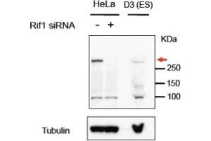 Western Blotting (WB) image for anti-RAP1 Interacting Factor Homolog (RIF1) (C-Term) antibody (ABIN2465112) (RIF1 抗体  (C-Term))