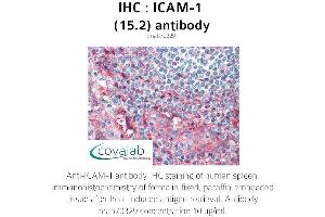 Image no. 2 for anti-Intercellular Adhesion Molecule 1 (ICAM1) antibody (ABIN1723250) (ICAM1 抗体)