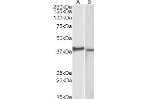 ABIN2562069 (2µg/ml) staining of Kelly (A) and U251-MG (B) lysates (35µg protein in RIPA buffer). (CX3CR1 抗体  (N-Term))