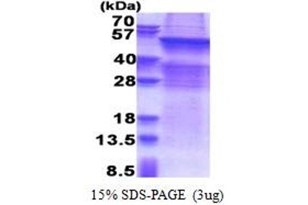 UGT8 Protein (AA 21-541) (His tag)