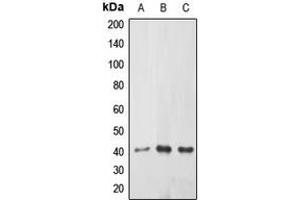 Western blot analysis of ABHD9 expression in HEK239T (A), mouse kidney (B), rat kidney (C) whole cell lysates. (ABHD9 抗体  (Center))