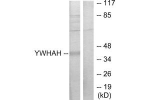 Western blot analysis of extracts from Jurkat cells, using 14-3-3 eta antibody. (14-3-3 eta 抗体  (Internal Region))
