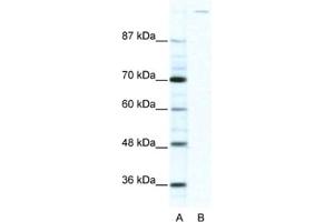 Western Blotting (WB) image for anti-Zinc Finger Protein GLI1 (GLI1) antibody (ABIN2460438) (GLI1 抗体)