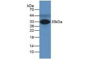 Detection of FCN3 in Human Serum using Polyclonal Antibody to Ficolin 3 (FCN3) (FCN3 抗体  (AA 34-297))