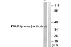 Western blot analysis of extracts from NIH-3T3 cells, using DNA Polymerase beta Antibody. (POLB 抗体  (AA 286-335))