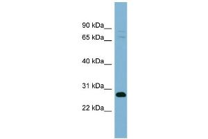 WB Suggested Anti-TMEM176A Antibody Titration:  0. (TMEM176A 抗体  (Middle Region))