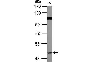 WB Image Sample (30 ug of whole cell lysate) A: A549 7. (BACE1 抗体)