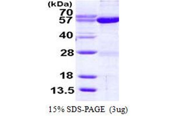 Seryl-tRNA Synthetase (SARS) (AA 1-514) protein (His tag)