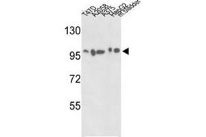 Western Blotting (WB) image for anti-Actinin, alpha 4 (ACTN4) antibody (ABIN3003494) (alpha Actinin 4 抗体)