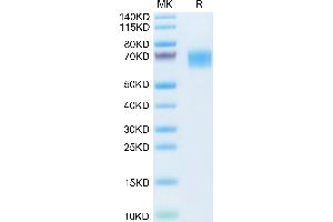 TYRO3 Protein (AA 31-419) (His tag)