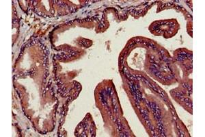 Immunohistochemistry of paraffin-embedded human prostate tissue using ABIN7149984 at dilution of 1:100 (DPP4 抗体  (AA 473-588))