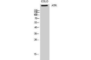 Western Blotting (WB) image for anti-ATR serine/threonine kinase (ATR) (Ser16) antibody (ABIN3173961) (ATR 抗体  (Ser16))