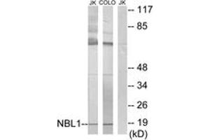 Western blot analysis of extracts from Jurkat/COLO cells, using NBL1 Antibody. (NBL1 抗体  (AA 131-180))