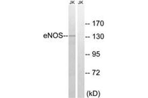 Western Blotting (WB) image for anti-Nitric Oxide Synthase 3 (Endothelial Cell) (NOS3) (AA 1144-1193) antibody (ABIN2888981) (ENOS 抗体  (AA 1144-1193))