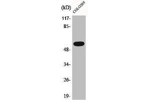 Western Blot analysis of COLO205 cells using Phospho-Akt (T308) Polyclonal Antibody (AKT 1/2/3 抗体  (pThr308))