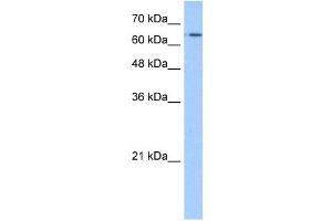 WB Suggested Anti-SLC22A11 Antibody Titration:  1. (SLC22A11 抗体  (N-Term))