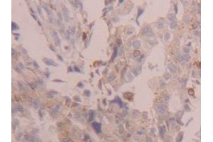 Used in DAB staining on fromalin fixed paraffin-embedded Kidney tissue (Cathepsin D 抗体  (AA 23-161))