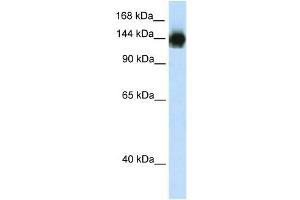 TIMELESS antibody (20R-1198) used at 0. (TIMELESS 抗体  (N-Term))