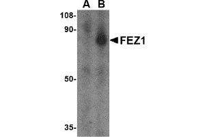 Western Blotting (WB) image for anti-Fasciculation and Elongation Protein zeta 1 (Zygin I) (FEZ1) (C-Term) antibody (ABIN1030392) (FEZ1 抗体  (C-Term))