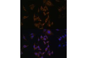 Immunofluorescence analysis of HeLa cells using UBE2L6 antibody (ABIN6134446, ABIN6149808, ABIN6149809 and ABIN6217753) at dilution of 1:100. (UBE2L6 抗体  (C-Term))