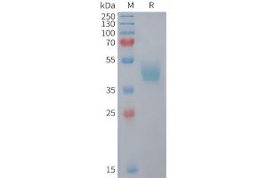 Mouse Protein, hFc Tag on SDS-PAGE under reducing condition. (CCR6 Protein (AA 1-39) (Fc Tag))