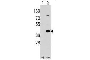 Image no. 1 for anti-Epilepsy, Progressive Myoclonus Type 2A, Lafora Disease (Laforin) (EPM2A) (C-Term) antibody (ABIN356954) (EPM2A 抗体  (C-Term))