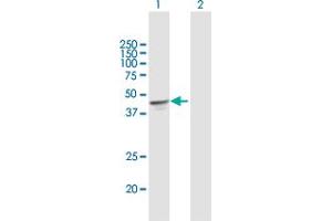 Western Blot analysis of OXA1L expression in transfected 293T cell line by OXA1L MaxPab polyclonal antibody. (OXA1L 抗体  (AA 1-435))