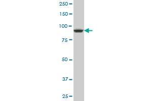 DDX54 polyclonal antibody (A01), Lot # 050914JC01 Western Blot analysis of DDX54 expression in HepG2 . (DDX54 抗体  (AA 778-881))