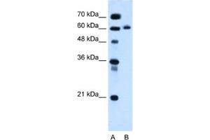 Western Blotting (WB) image for anti-Inositol 1,4,5-Triphosphate Receptor Interacting Protein-Like 1 (ITPRIPL1) antibody (ABIN2463966) (ITPRIPL1 抗体)