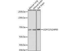 Western blot analysis of extracts of various cell lines, using U2/U2/U2 Rabbit mAb (ABIN1682786, ABIN3019042, ABIN3019043 and ABIN7101704) at 1:1000 dilution. (U2AF2 抗体)