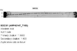 Image no. 3 for anti-Suppressor of Cytokine Signaling 1 (SOCS1) (N-Term) antibody (ABIN2777164) (SOCS1 抗体  (N-Term))