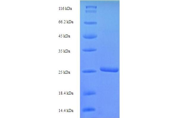 SCRG1 Protein (AA 21-98) (His-SUMO Tag)