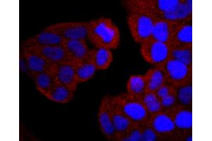 HeLa cells were stained with PI 3 Kinase p85 alpha (2G4) Monoclonal Antibody  at [1:200] incubated overnight at 4C, followed by secondary antibody incubation, DAPI staining of the nuclei and detection. (PIK3R1 抗体)