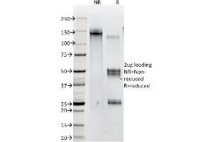 SDS-PAGE Analysis of Purified Catenin, beta Mouse Monoclonal Antibody (12F7). (CTNNB1 抗体  (N-Term))