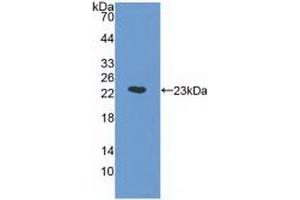 Western blot analysis of recombinant Human a1AGP. (ORM1 抗体  (AA 19-201))