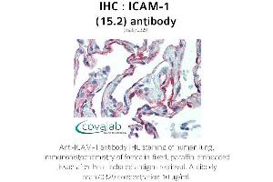 Image no. 1 for anti-Intercellular Adhesion Molecule 1 (ICAM1) antibody (ABIN1723250) (ICAM1 抗体)