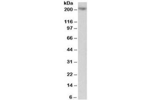 Western blot testing of Jurkat lysate with MYO5A antibody at 1ug/ml. (MYO5A 抗体)
