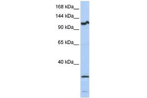 WB Suggested Anti-OSMR Antibody Titration:  0. (Oncostatin M Receptor 抗体  (Middle Region))