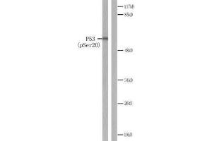 Western blot analysis of extracts from COS7 cells treated with (p53 抗体  (pSer20))