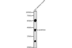 Western blot analysis of extracts of Rat skeletal muscle, using  antibody (ABIN6127413, ABIN6136583, ABIN6136584 and ABIN6216527) at 1:1000 dilution. (Adiponectin Receptor 2 抗体  (AA 1-80))